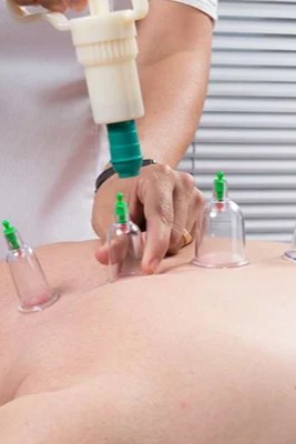 الحجامه العلاجيه